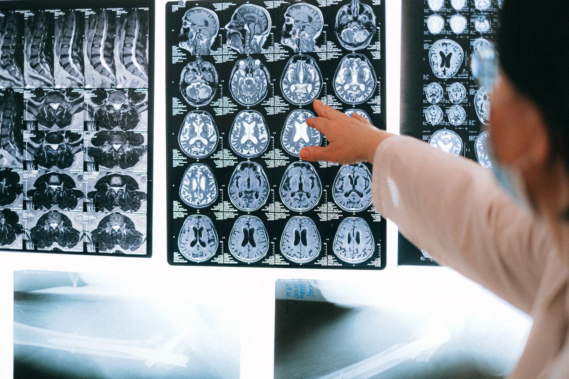 Porretta, visite neurologiche con robot collegato a Bologna